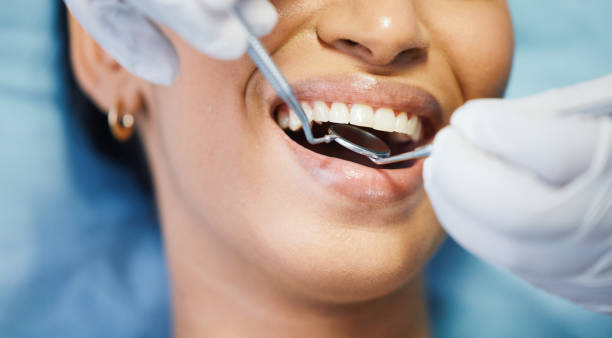 Best Same-Day Emergency Dental Services in Centerburg, OH