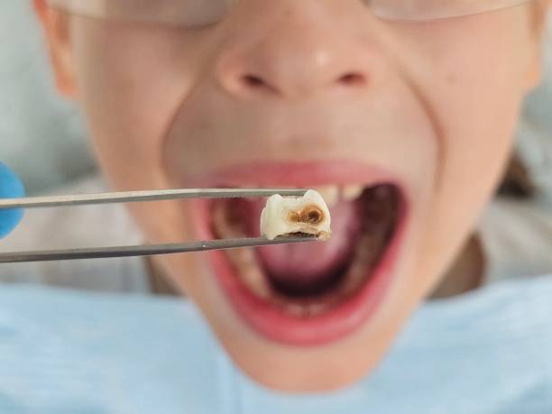 Best Same-Day Emergency Dental Services in Centerburg, OH