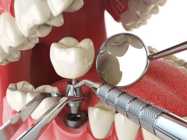 Best Same-Day Emergency Dental Services in Centerburg, OH